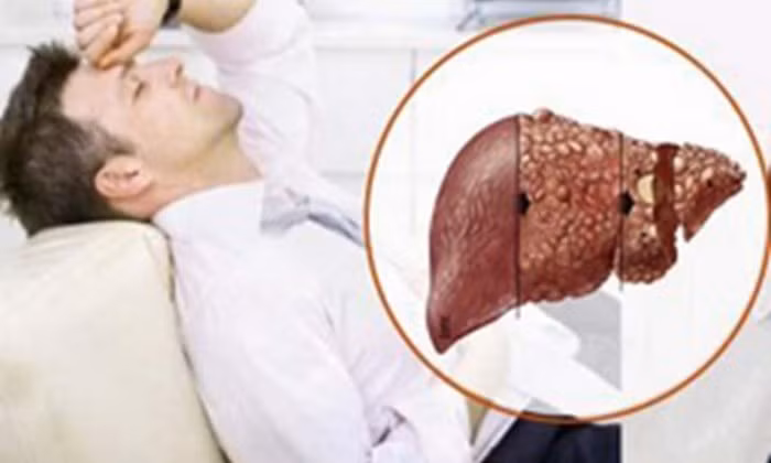 Chữa bệnh viêm gan mãn tính. Dùng 1l giấm gạo, 500g xương lợn, 120g đường đỏ, 120g đường trắng. Xương lợn chặt nhỏ rồi cho giấm, đường vào nồi, không cho nước, khuấy đều, đun nhỏ lửa 30 – 45 phút, gạn lấy nước uống sau bữa ăn. Người lớn mỗi lần 30 – 40ml, ngày 3 lần. Ảnh: Alobacsy.