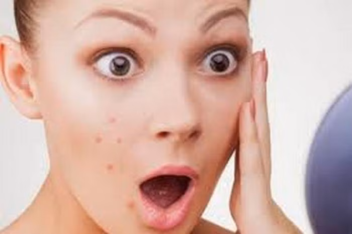 Tuy nhiên, đồ uống chứa caffeine có thể sẽ ảnh hưởng nặng đến tiêu hóa và khiến bạn mất ngủ. Hơn nữa, cà phê cũng làm bạn mọc mụn. Do vậy, nó không phải là phương pháp tối ưu nhất cho sức khỏe. Ảnh: Zingnews.