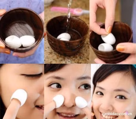 Ngâm kén vào cốc nước nóng khoảng 50 - 70°C, khoảng 5 phút làm cho kén mềm ra. Vớt kén tằm ra, vẩy bớt nước trên kén rồi bắt đầu massage lên da mặt trong vòng 10 - 15 phút để dưỡng chất thấm hết vào da. Mụn đầu đen, mụn cám sẽ tự động bị đánh bật. Ảnh: caobidao.com.vn.