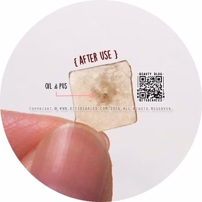 Miếng dán mụn có thiết kế đặc biệt, hình tròn, nhỏ xíu và trong suốt. Bạn có thể dùng nó dán lên vết mụn. Vết mụn sẽ khô lại và nhân mụn theo miếng dán ra ngoài. Tùy từng loại mụn sẽ có kích cỡ phù hợp.