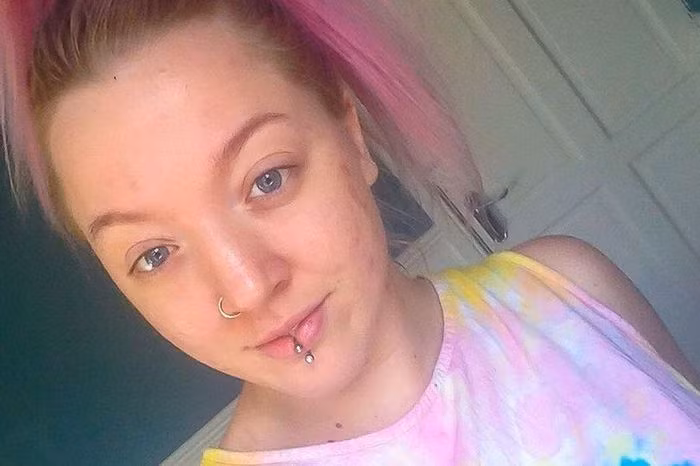 Jodie Broadley, 26 tuổi đến từ Anh là một cô gái có vẻ ngoài xinh xắn. Tuy nhiên, cô lại mắc căn bệnh tâm thần khủng khiếp được gọi bệnh mặc cảm ngoại hình (Body Dysmorphic Disorder -BDD, hay còn gọi là hội chứng sợ xấu) làm thay đổi nhận thức của cô về ngoại hình của mình.