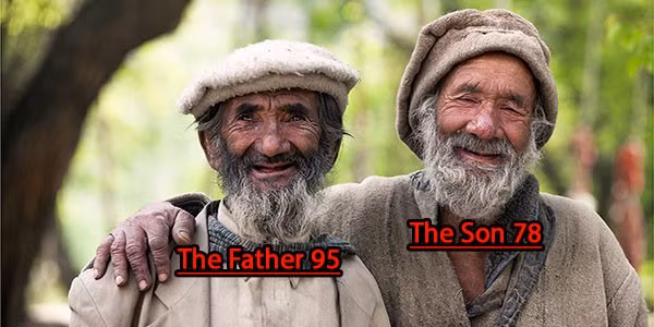 Bi mat truong tho cua bo toc song hon 100 tuoi khong benh tat-Hinh-2