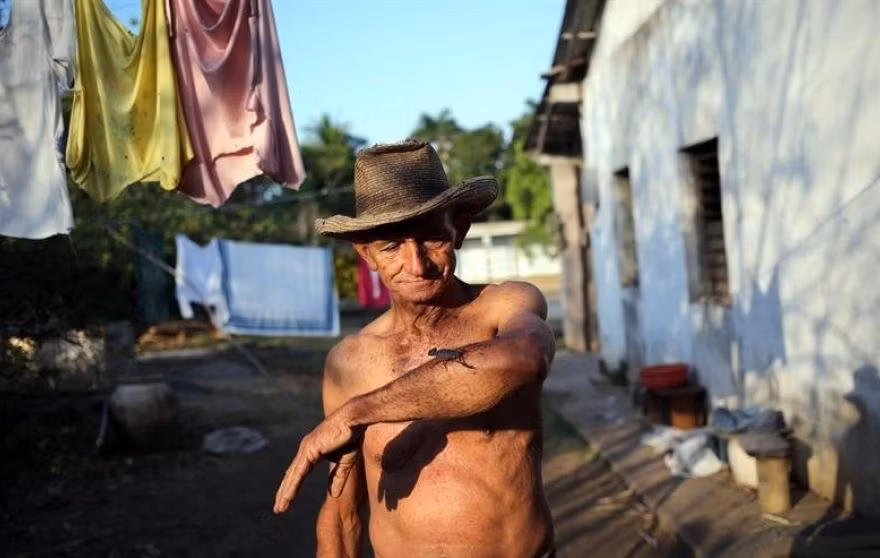 Cach chua benh voi noc doc bo cap ky la cua nguoi Cuba-Hinh-2