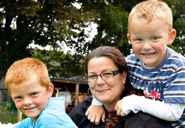 Điển hình là cặp song sinh Marcus và Lucas nổi tiếng trên toàn cầu về hiện tượng hiếm gặp này. Marcus lùn, mập, tóc đỏ rất nghịch ngợm còn Lucas thì cao lớn, tóc vàng và cậu bé điềm tĩnh hơn.