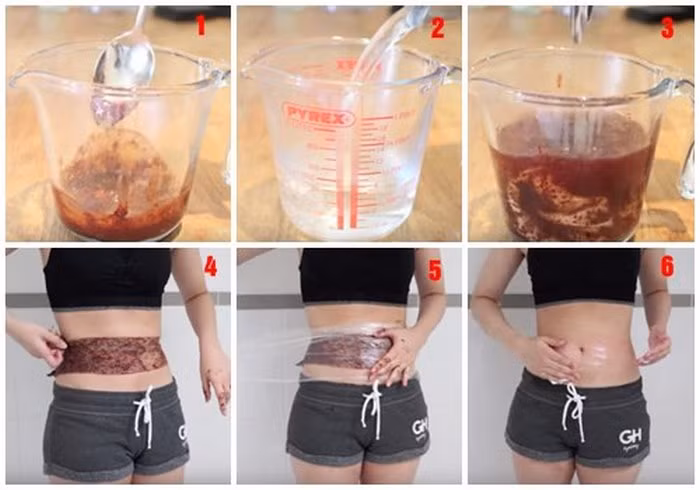 Dùng băng quấn này quấn quanh vùng muốn giảm mỡ. Tiếp theo, lấy màng bọc thực phẩm quấn quanh vùng da. Sau 1 tiếng, gỡ băng ra sẽ thấy bụng bạn sẽ hơi đỏ lên. Lấy khăn sạch lau khắp bụng rồi dùng kem dưỡng ẩm thoa lên da để vết đỏ dịu dần. Ảnh: Myphammaihan.