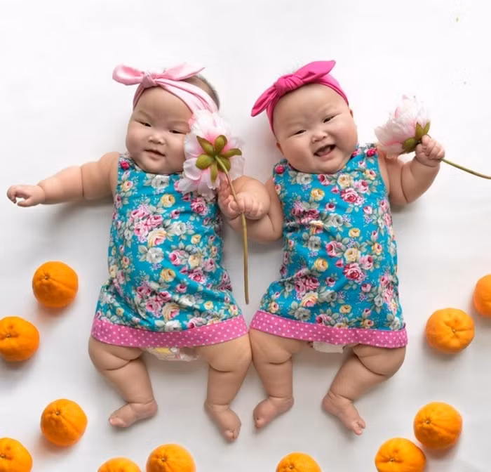 Thậm chí khi đó, các bác sỹ sản khoa cũng không tự tin đưa ra thời điểm chính xác để khuyên nên sinh hai bé.