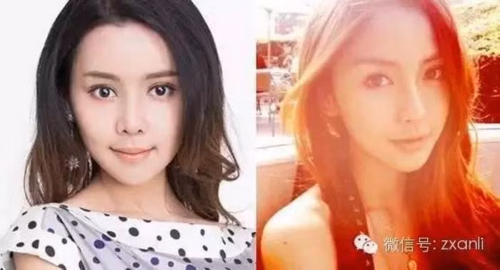 Cô thừa nhận mình đã phẫu thuật cắt mắt hai mí, cắt mở rộng khóe mắt, cấy ghép mỡ vào mặt, gọt xương gò má, kéo dài xương hàm, nâng mũi, căng da mặt… Tổng cộng hơn 10 cuộc phẫu thuật lớn nhỏ. Bây giờ, cô sở hữu một gương mặt long lanh gần giống với bà xã của Huỳnh Hiểu Minh. Ảnh: Zxani.