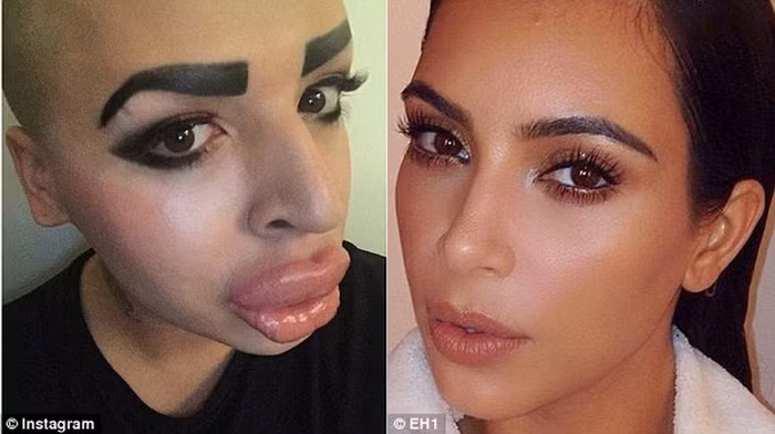 Fan nam phẫu thuật thành cô Kim “siêu vòng 3”. Một fan cuồng 23 tuổi có tên Jordan James Parke đã bỏ ra 150.000 USD (hơn 3 tỷ đồng) để phẫu thuật thẩm mỹ cho giống thần tượng của mình. Ảnh: Khampha.