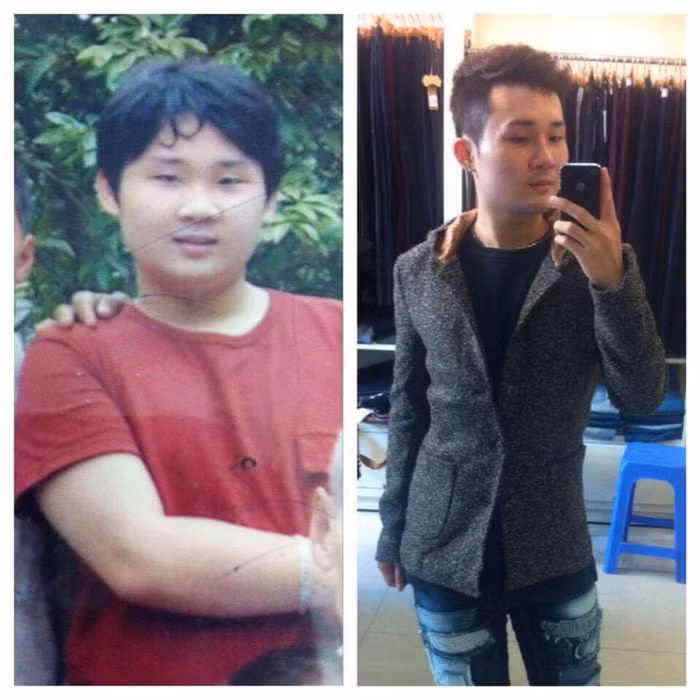 Rút xương sườn. Anh chàng Phạm Công Minh (sinh năm 1993) mới đây đã kể lại câu chuyện đi rút xương sườn khiến cư dân mạng rùng mình. Công Minh kể, ngay từ hồi cấp 2, anh bị bạn bè chê cười vì thân hình quá khổ. Chưa kể đến thân hình quá béo khiến chàng trai trẻ có nguy cơ mắc bệnh gan. Ảnh: Vietgiaitri.