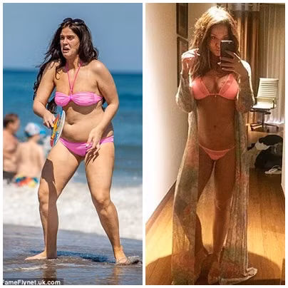 Vicky Pattison. Ngôi sao truyền hình nổi tiếng có thời đã từng bị béo phì bởi sở thích ăn thịt nướng. Sau khi quyết tâm ăn kiêng và giảm hơn 19 kg thì cô đã đạt được trọng lượng như ý. Cô thực hiện chế độ nghiêm ngặt chế độ low carb và tập thể dục cường độ cao.