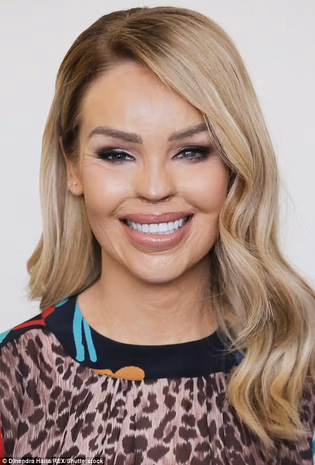 Rồi sau đó, cô đã ký hợp đồng với một kênh truyền hình kể về câu chuyện cuộc đời mình, viết sách. Sau khi lên sóng truyền hình nhiều hơn, Katie bắt đầu học cách trang điểm để khán giả đỡ sợ hơn. Và quả thật, make up mang lại cho cô cái nhìn khác hơn hẳn. 