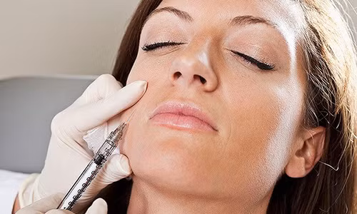 Hoại tử mặt do tiêm chất làm đầy ở cơ sở không phép Hoai tu mat do tiem chat lam day o co so khong phep