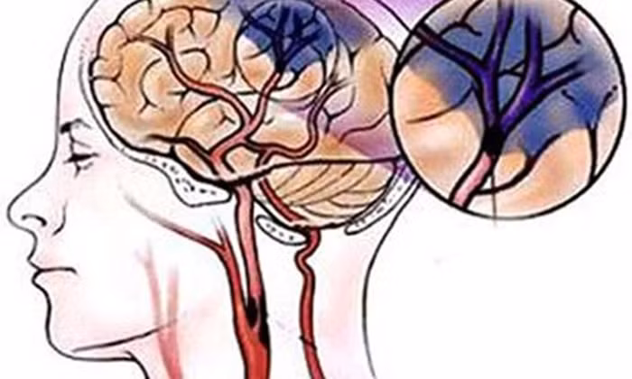 Bệnh thiếu máu. Nhân lạc, hạt sen (bỏ vỏ và tâm sen), mỗi thứ 30g; cẩu khởi 15g, táo tàu 9 quả, đường đỏ lượng vừa phải, thêm 300ml nước vào nấu cách thủy cho nhừ, ngày ăn 1-2 lần. Ảnh: Healplus.