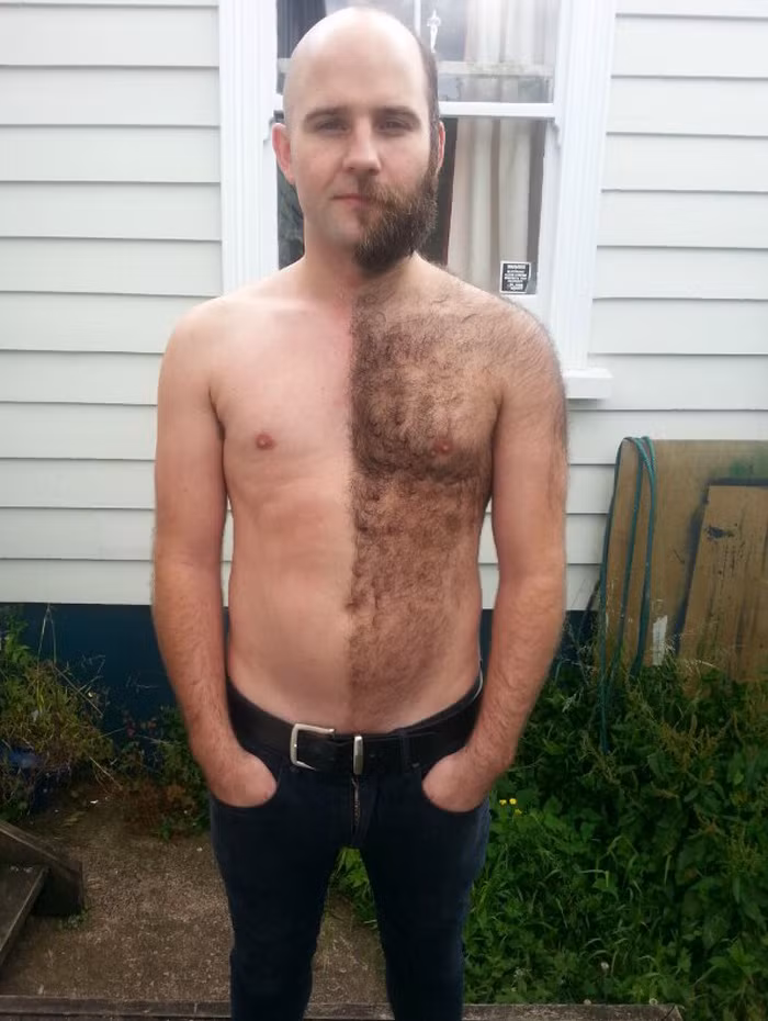 Anh chàng này còn hài hước chỉ cạo một nửa để mọi người dễ so sánh hơn.