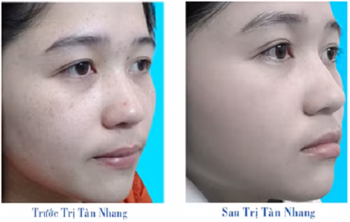 Tiếp tục thái chúng thành các lát mỏng rồi bỏ toàn bộ vào máy xay sinh tố nghiền nhuyễn với sữa chua không đường. Đổ hỗn hợp vào bát rồi tiến hành thực hiện các bước làm đẹp với hỗn hợp này như 2 công thức trên. Ảnh: thammycongnghecao.org.