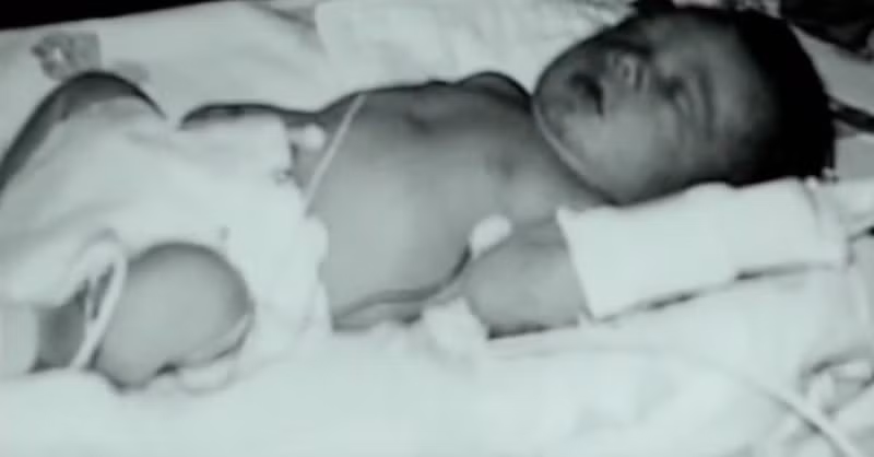 Linh cảm người mẹ và sự hồi phục lạ của đứa con bị tật não Linh cam nguoi me va su hoi phuc la cua dua con bi tat nao