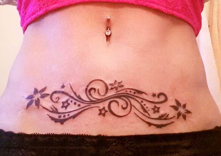 Hay như bà mẹ này đã chọn hình xăm nghệ thuật để che đi vết mổ sinh con của mình.