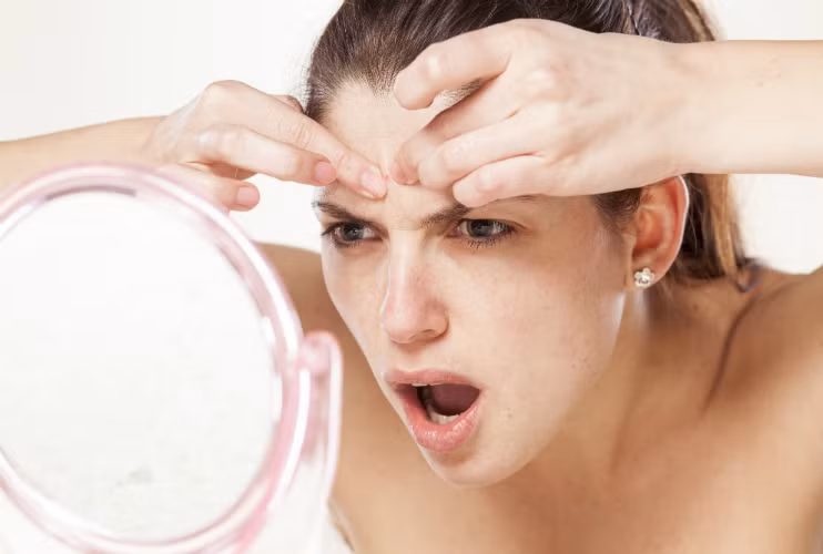 6. Giảm sưng đau do mụn nhọt (mụn nhọt chưa mưng mủ): Lá mần tưới tươi 50g, rửa sạch, giã nát đắp nơi có mụn nhọt. Ngày đắp 2 lần vào buổi sáng và tối, mỗi lần 10-15 phút. Bài thuốc này giúp giảm sưng, đau do mụn nhọt nhanh chóng. Ảnh: dieutrimundrhue.com.