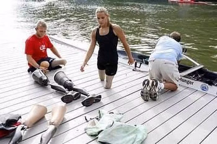 Gia đình mới đối xử rất tốt với Oksana. Cô bé được chữa trị nhưng đôi chân vẫn không thể đi lại. Đến năm 9 tuổi, theo lời khuyên của bác sỹ, Oksana phẫu thuật cắt chân để có thể sống như một người bình thường với đôi chân giả.