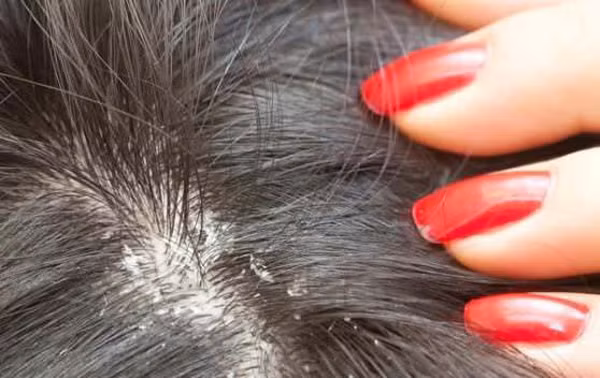 Trị gàu hiệu quả, làm đẹp tóc: Phụ nữ dùng lá nấu nước gội đầu. Ảnh: minhlacongai.com.