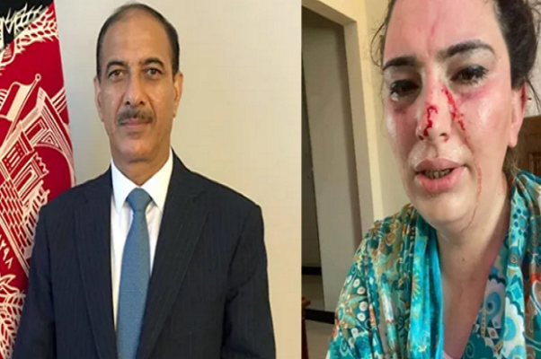 Chân dung con gái Đại sứ Afghanistan bị bắt cóc, tra tấn tại Pakistan - Hình 4 Chan dung con gai Dai su Afghanistan bi bat coc, tra tan tai Pakistan-Hinh-4