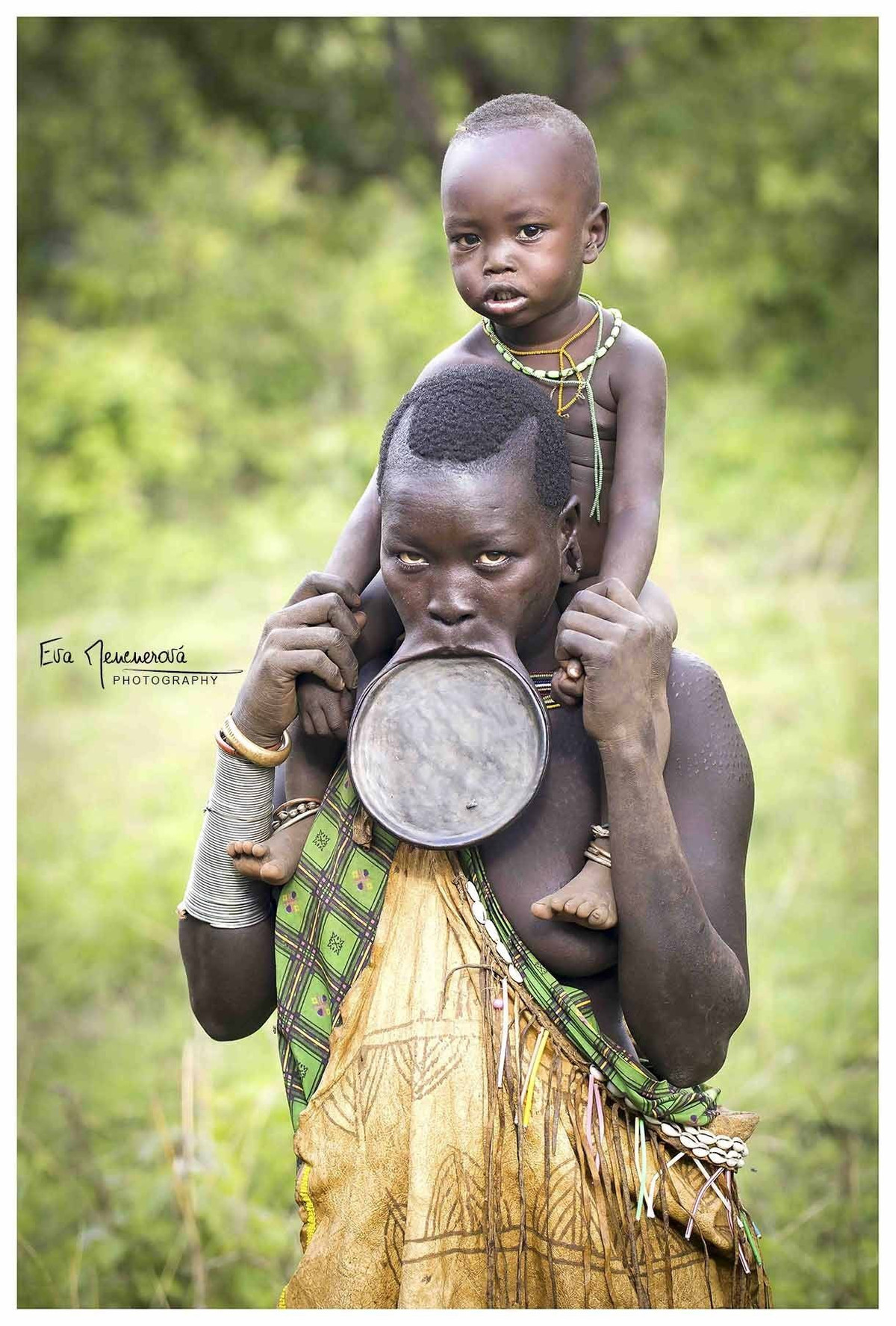 Do đeo những chiếc đĩa có kích thước lớn và nặng nên phụ nữ gặp nhiều khó khăn trong ăn uống, nói chuyện. Ngay cả khi cười họ cũng gặp một số trở ngại.