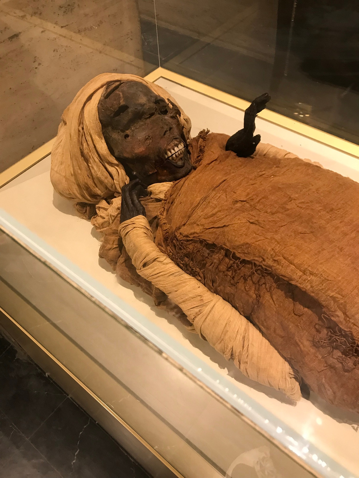 Kết quả kiểm tra xác ướp của các chuyên gia hé lộ Seqenenre Taa II có đôi tay biến dạng. Đây được cho là bằng chứng về việc ông bị trói 2 tay sau lưng.