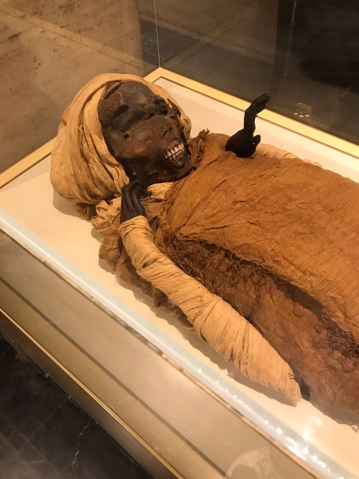 Kết quả kiểm tra xác ướp của các chuyên gia hé lộ Seqenenre Taa II có đôi tay biến dạng. Đây được cho là bằng chứng về việc ông bị trói 2 tay sau lưng.