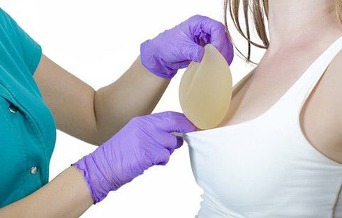 Nang nguc co nguy co ung thu: Bac si Benh vien K noi gi?