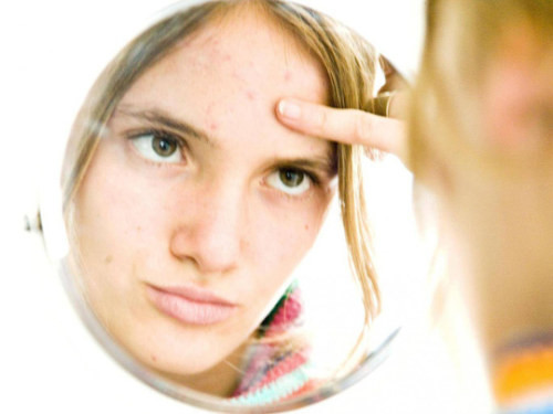 Vàng với khả năng dẫn nhiệt và kháng khuẩn đã được tận dụng để chống lại mụn trứng cá. Ảnh: INDEPENDENT Vàng với khả năng dẫn nhiệt và kháng khuẩn đã được tận dụng để chống lại mụn trứng cá. Ảnh: INDEPENDENT