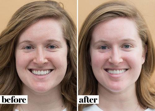 Trước và sau khi tẩy da chết.