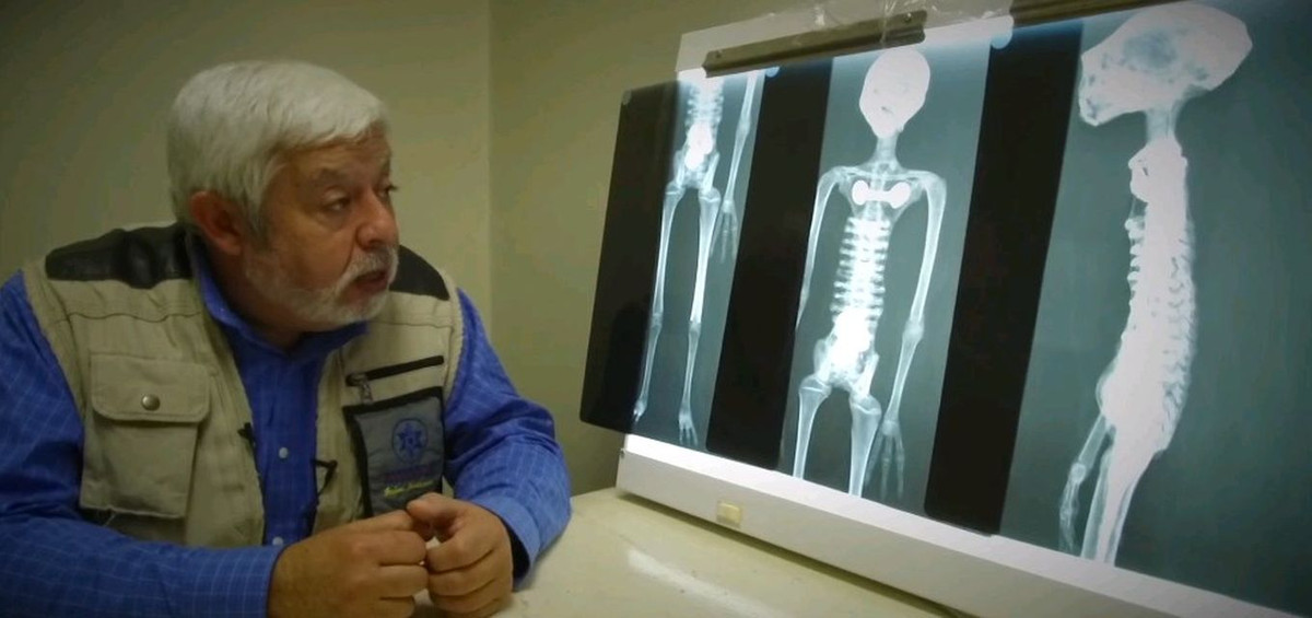 Căn cứ vào những hình ảnh mà ông Maussan công bố, xác ướp có 3 ngón tay và hộp sọ dài bất thường. Mỗi xác ướp cao 167cm.