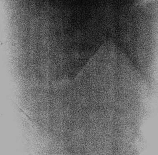 Trong chuyến bay cuối cùng lên Mặt trăng, tàu Apollo 17 của Mỹ đã chụp được một bức ảnh có một khối hình trông giống ngọn núi hoặc kim tự tháp. Hiện giới chuyên gia chưa đưa ra bất cứ lời giải nào về bức ảnh này.