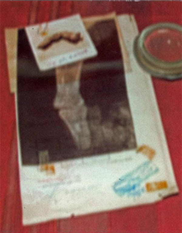 Với kích thước "khủng" trên, các chuyên gia ước tính nó thuộc về một người cao khoảng 5m, nặng từ 600 - 800 kg.