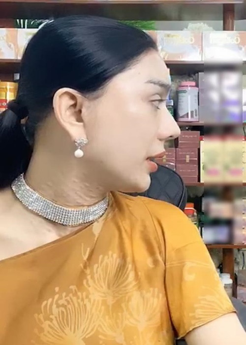 Vùng da cổ là khuyết điểm sắc vóc của mỹ nhân chuyển giới này. Ảnh: Công lý và xã hội
