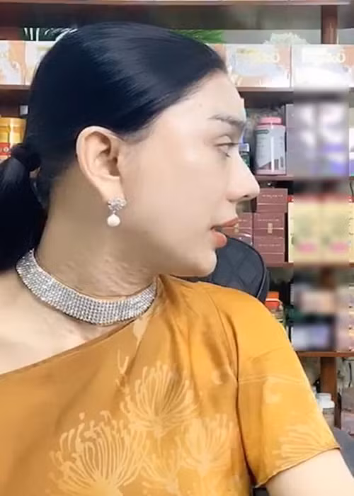 Vùng da cổ là khuyết điểm sắc vóc của mỹ nhân chuyển giới này. Ảnh: Công lý và xã hội