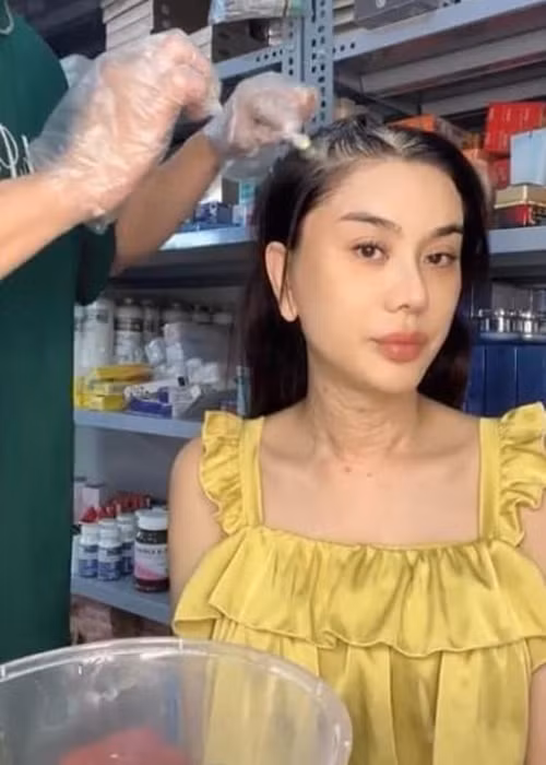 Mới đây, Lâm Khánh Chi bị soi vùng da cổ nhăn nheo, sần sùi, nổi hạt. Phía mỹ nhân Việt chuyển giới này giải thích cô bị dị ứng mà thôi. Ảnh: Công lý và xã hội