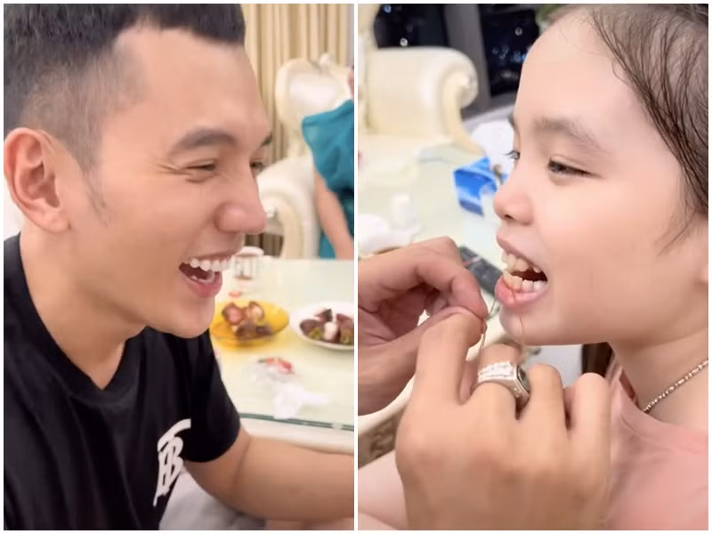 Mới đây, Lý Bình giúp bé Mia - con gái riêng của Phương Trinh Jolie loại bỏ chiếc răng xấu. Trước đó, anh cũng có những hành động quan tâm dành cho bé Mia. Ảnh: Yan