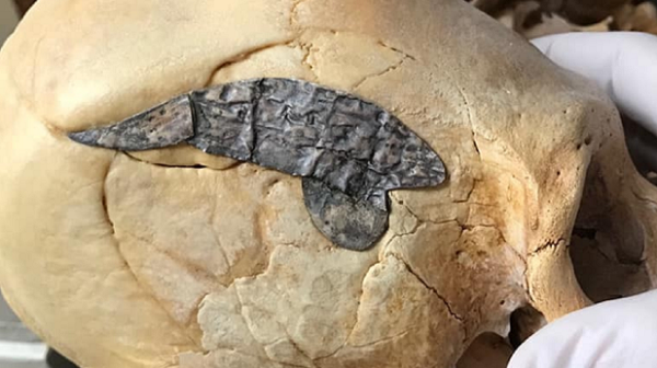 Theo các nhà khoa học, hình dáng của hộp sọ này không gây ngạc nhiên vì nó được tìm thấy ở nơi từng có bằng chứng về việc trẻ em bị siết chặt đầu để tạo hình sọ dài, như một kiểu làm đẹp đáng sợ thời cổ đại.