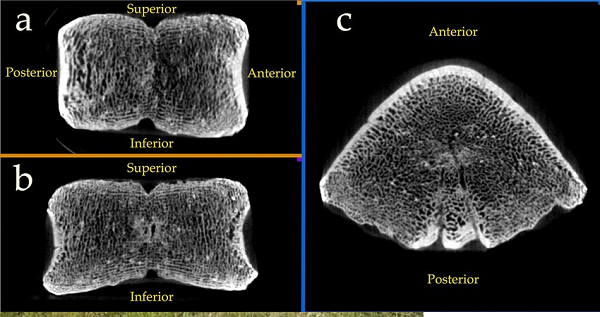 Vì vậy, cậu bé này là một người khổng lồ kỳ lạ trong thế giới các loài người tuyệt chủng và các nhà khoa học vẫn chưa thể biết được cậu thuộc loài nào của chi Người (Homo) từng rất đa dạng.