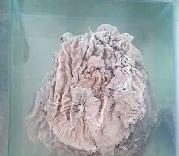 Loại nấm này sinh trưởng và phát triển trên mặt đất với bề ngoài giống với những gốc cây rất khó phát hiện, trên bề mặt có khá nhiều vân, vỏ ngoài cứng như gỗ nhưng phần thịt nấm bên trong lại mềm và có tính đàn hồi.