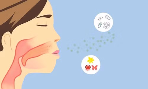 Loai “viem hong” dang so, nguy kich trong thoi gian cuc ngan-Hinh-2