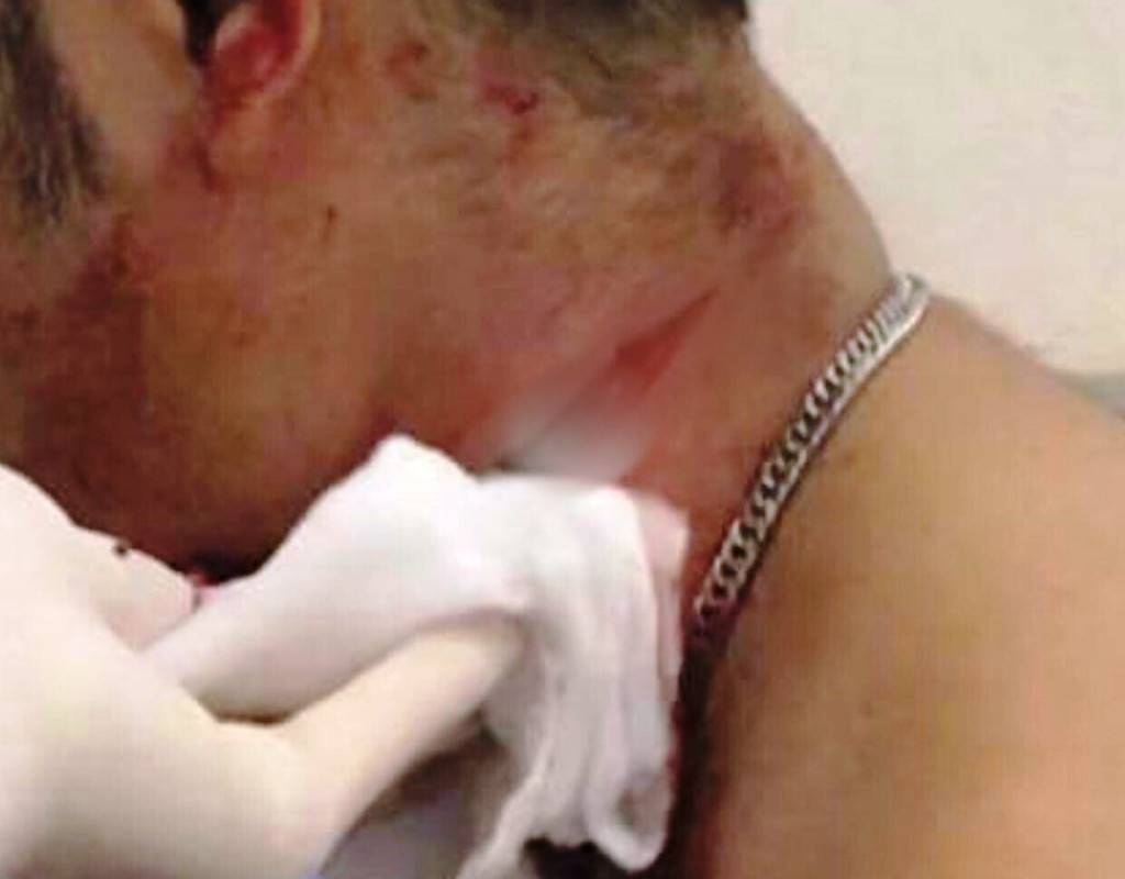 Một trong những công nhân bị thương.