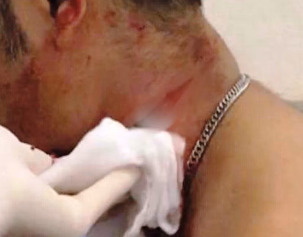 Một trong những công nhân bị thương.