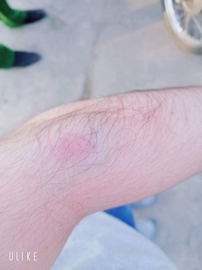 Nhac thanh nien chay xe cau tha, hai bo con bi danh chay mau giua duong-Hinh-2