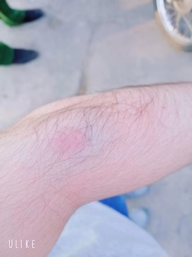 Nhac thanh nien chay xe cau tha, hai bo con bi danh chay mau giua duong-Hinh-2