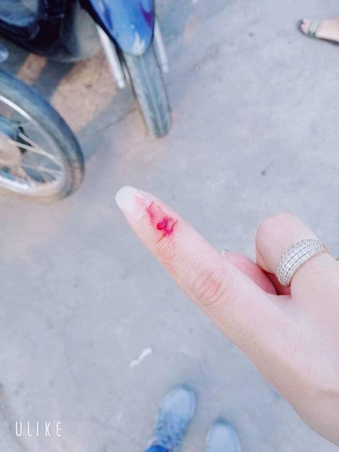 Nhac thanh nien chay xe cau tha, hai bo con bi danh chay mau giua duong-Hinh-3