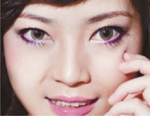 Còn nếu sở hữu nốt ruồi ở khóe mắt là người khá vất vả, luôn có chuyện phải lo. Tuy nhiên, những người này về sau làm ăn đều có lộc, khá giả.