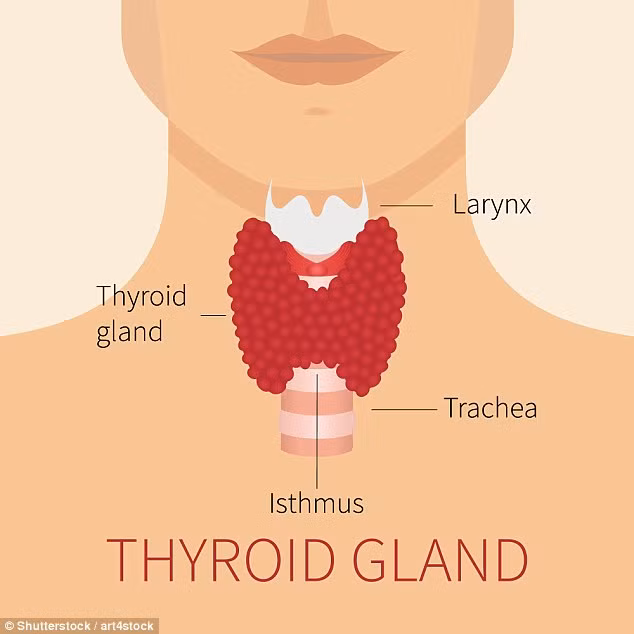 Kết quả một nghiên cứu mới đây cho thấy nàng Mona Lisa trong bức tranh nổi tiếng của Leonardo da Vinci mắc bệnh suy giáp.