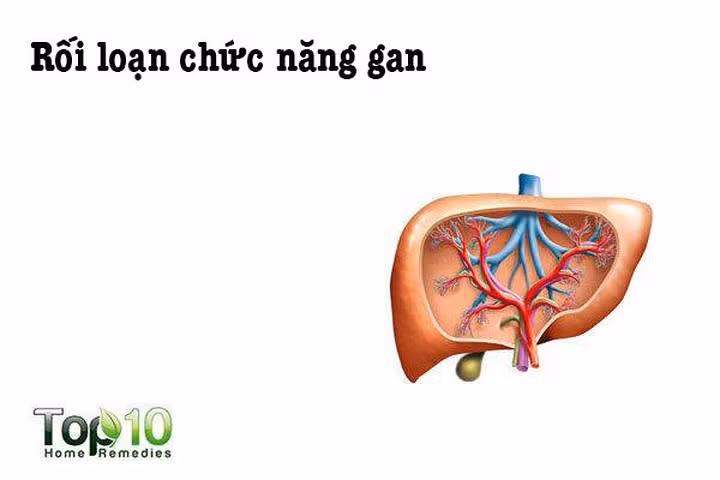 Rối loạn chức năng gan: Tổn thương gan là một nguy cơ thường gặp khi bạn dùng thuốc giảm đau mà không hỏi ý kiến bác sĩ. Trong số các loại thuốc giảm đau, aspirin và acetaminophen có thể gây hại cho gan của bạn. Đó là do độc tính của thuốc khi dùng liều cao.